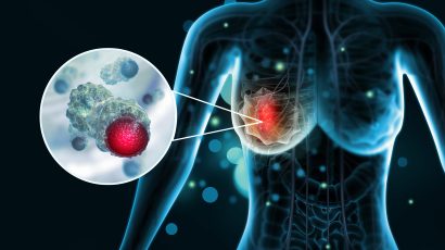 Carbon Footprint Savings Enabled by Tumour Profiling Test – Digistain