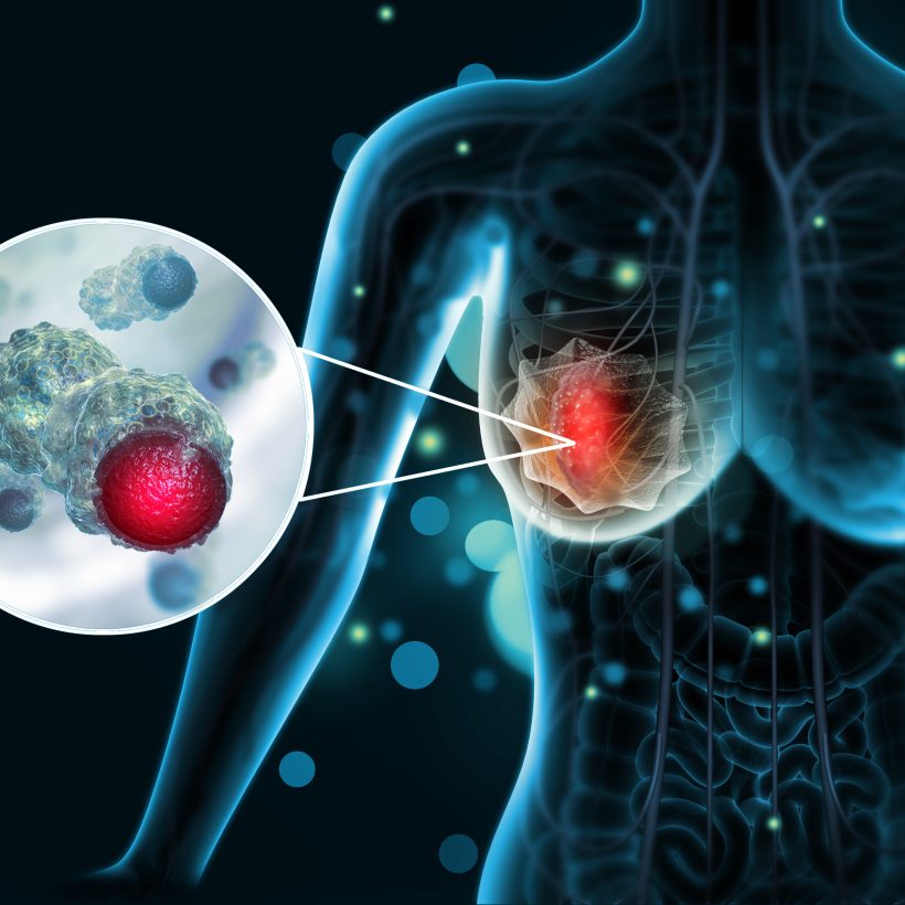 Carbon Footprint Savings Enabled by Tumour Profiling Test – Digistain