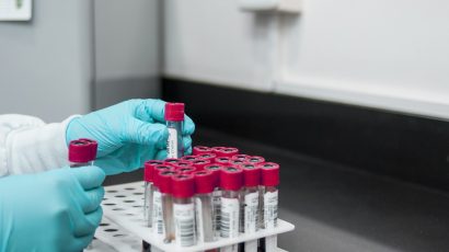 A liquid biopsy test which screens and predicts cardiovascular disease – MultiplAI