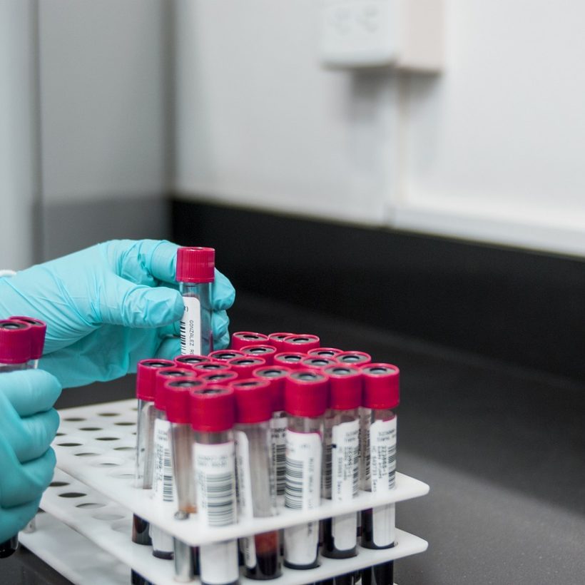 A liquid biopsy test which screens and predicts cardiovascular disease – MultiplAI