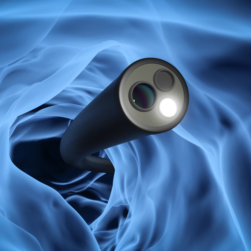 Robotic Device for Colonoscopy Procedures – Aker Health Tech