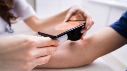 Waiting List Simulation of a Teledermoscopy Tool for Skin Cancer Screening​ – Open Medical