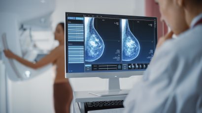 Cost Saving Analysis of a Tumour Profiling Test – Digistain