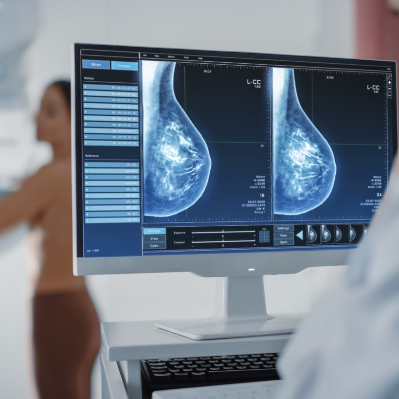 Cost Saving Analysis of a Tumour Profiling Test – Digistain
