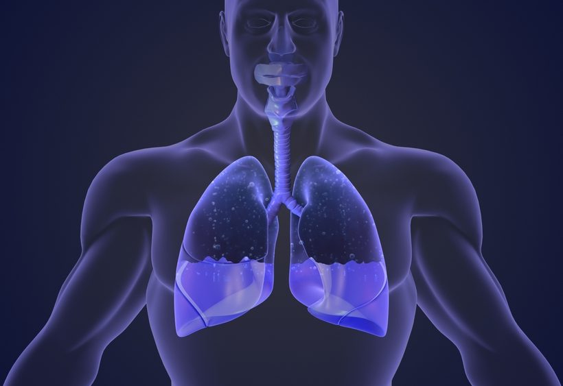 A Groundbreaking Solution to Avoid Delay in the Treatment of Pleural Effusion – Puddle Technology Ltd