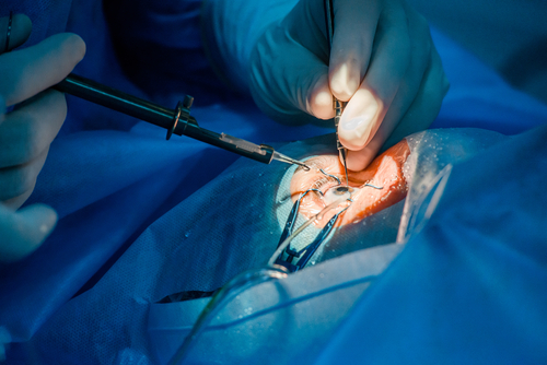Economic Analysis of a Novel Graft Material for Ophthalmology – The Electrospinning Company