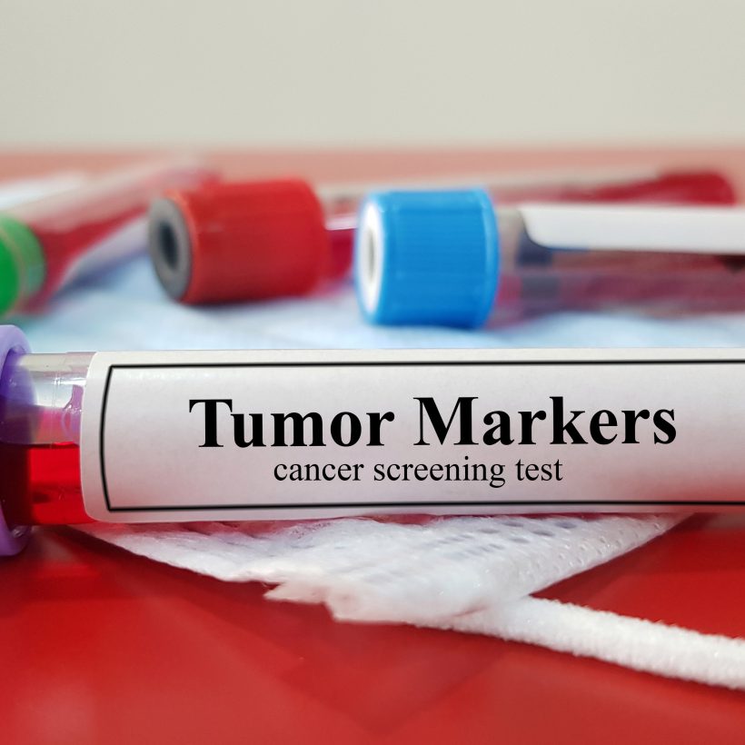 Early Detection and Diagnosis of Cancer – a Health Economist’s Perspective