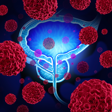 Cost Effectiveness Analysis on AI Tool to Support Diagnosis of Prostate Cancer – Lucida Medical